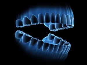 Concept Picture of High Tech Digital Image of Teeth