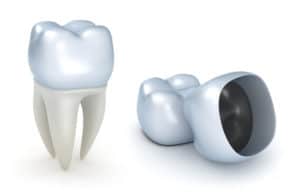 how do dental crowns work