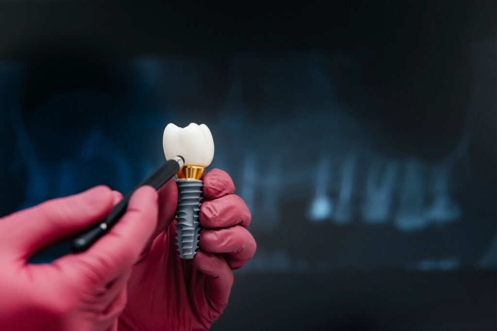 west allis implant restoration